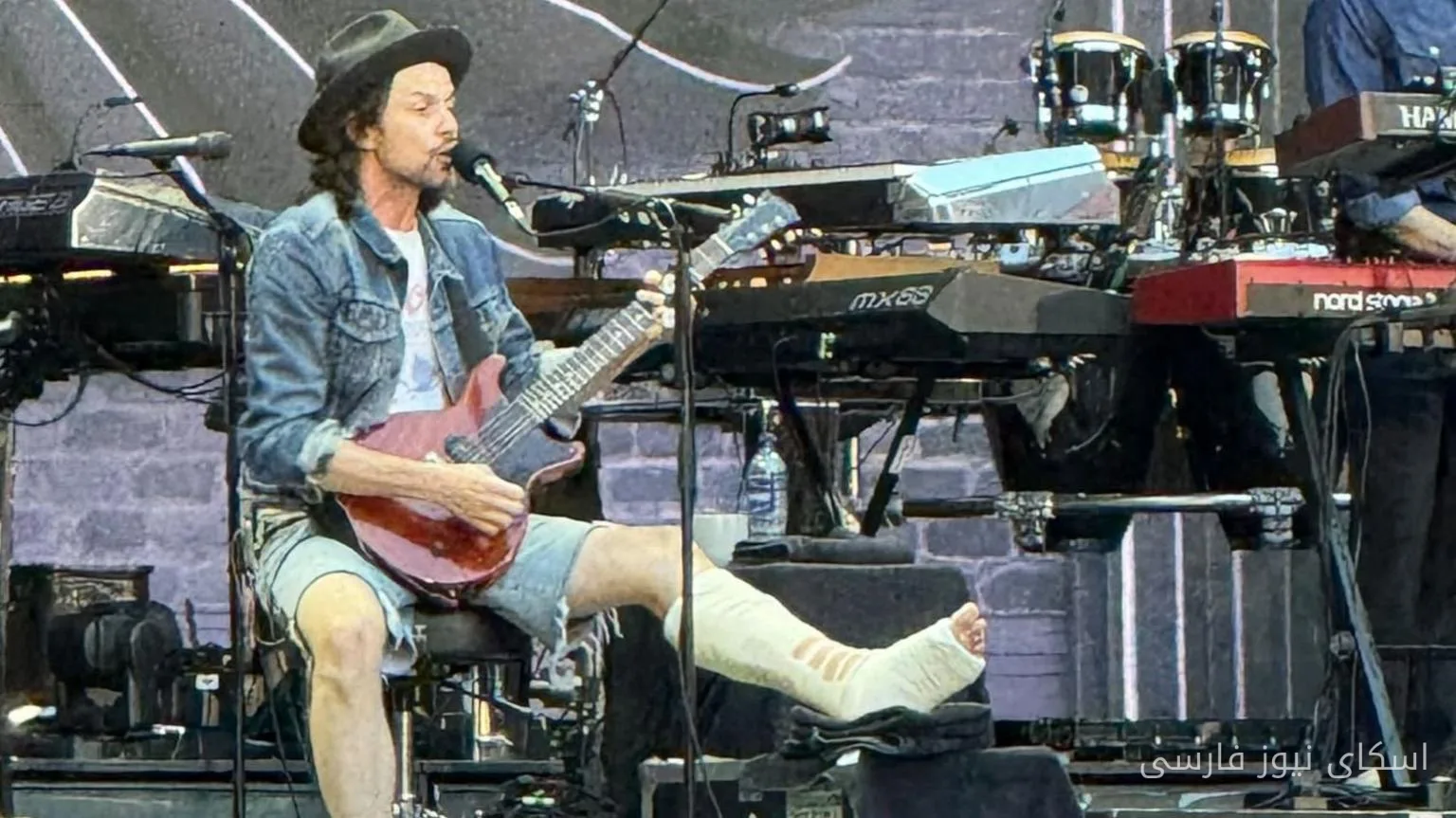 James Bay با پای شکسته در کنسرت Bon Jovi حاضر شد